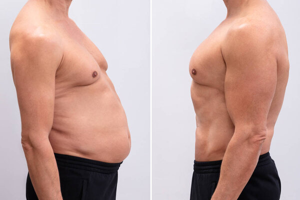 Побочный вид пожилого человека до и после потери жира на белом фоне. Форма тела была изменена во время ретуширования
