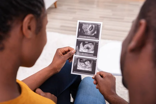 Primo Piano Una Coppia Attesa Guardando Ultrasuoni Scansione Rapporto — Foto Stock