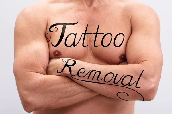 Testo Rimozione Del Tatuaggio Sul Petto Sulla Mano Shirtless Man — Foto Stock
