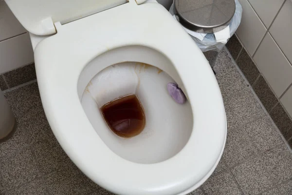 Förhöjd Bild Smutsiga Och Ohygieniska Toalett Stolen Med Flush Soap — Stockfoto