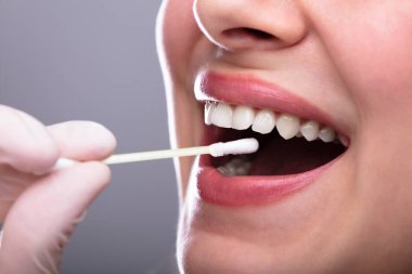 Dişçi el ile pamuklu çubukla kadın ağzından tükürük testi alarak