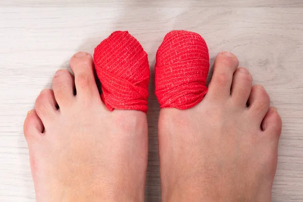 Zbliżenie Ludzkiej Nogi Czerwonym Bandażem Bolącym Paznokciu — Zdjęcie stockowe