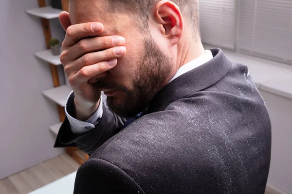 Side View Unhappy Businessman Hand Eyes Dandruff Black Suit — стоковое фото