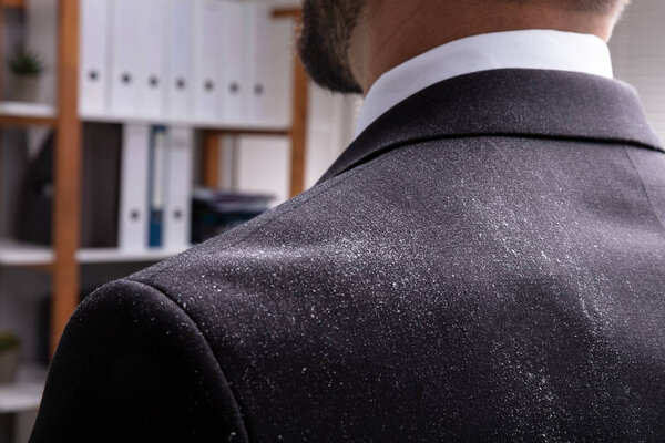 Крупный план бизнесмена в черном костюме с перхоти на плече
