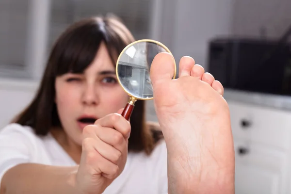 Chockad Ung Kvinna Tittar Hennes Naglar Med Förstoringsglas — Stockfoto