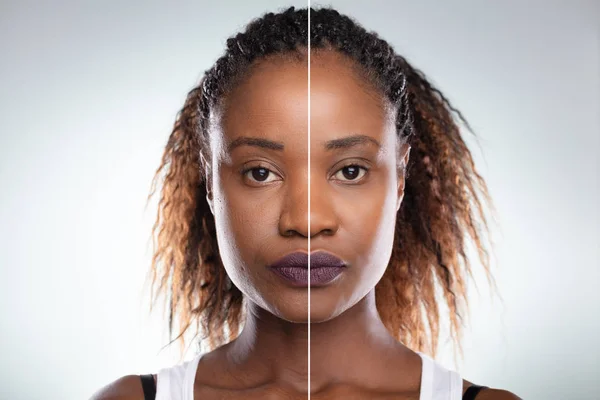 Nahaufnahme Des Gesichts Einer Jungen Frau Vor Und Nach Kosmetischen — Stockfoto