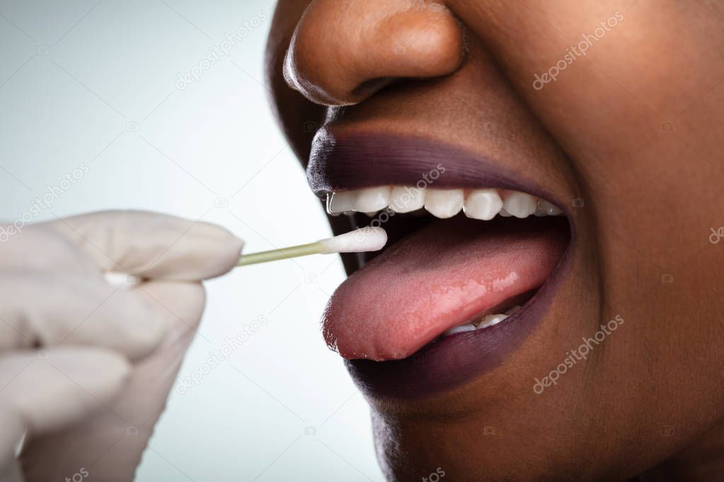 Dentist's Hand Taking Saliva Test From Woman's Mouth With Cotton Swab