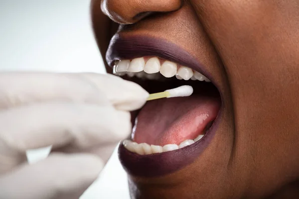 Dentist Hand Taking Saliva Test Woman Mouth Cotton Swab — Stock Photo, Image