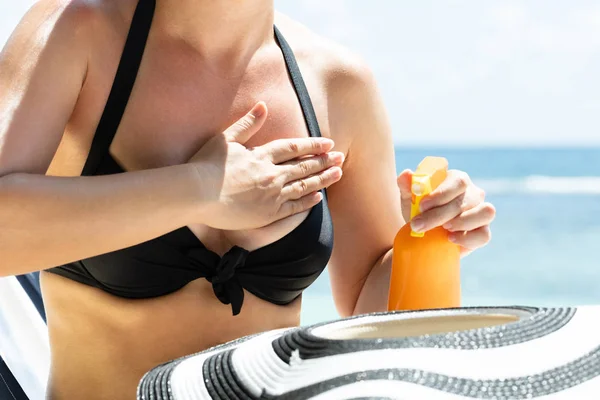 Close Van Een Vrouw Toepassing Zonnebrandcrème Lotion Haar Lichaam Het — Stockfoto