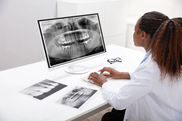 Médico Feminino Olhando Para Dentes Raio Computador Sobre Mesa Clínica — Fotografia de Stock