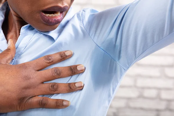 Hyperhidrosis 나쁘게 겨드랑이 아래와 여자의 — 스톡 사진