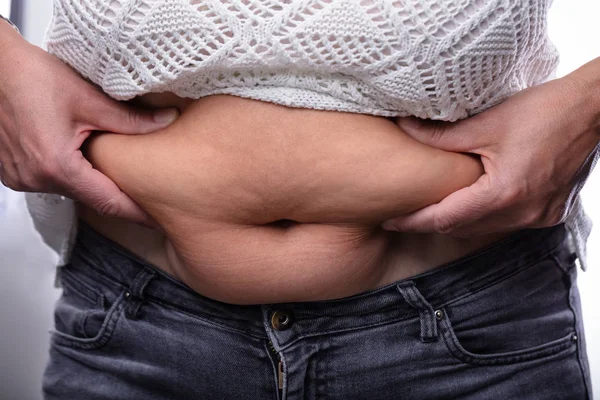 Zbliżenie Kobieta Pinching Brzuch Tłuszcz Jej Dwa Ręce — Zdjęcie stockowe
