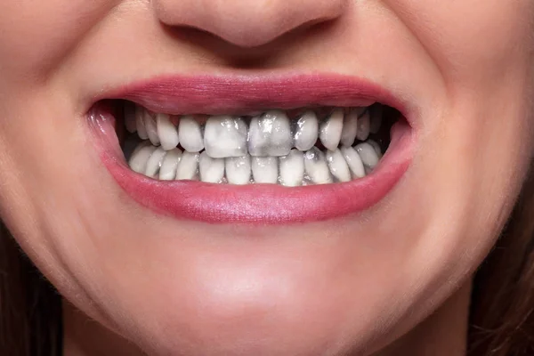 Close Mulher Limpando Seus Dentes Com Pasta Dentes Carvão — Fotografia de Stock