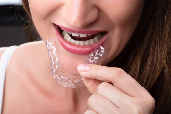 Primer Plano Mano Una Mujer Poniendo Alineador Transparente Los Dientes — Foto de Stock