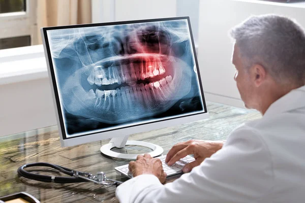 Primer Plano Mano Dentista Examinando Los Dientes Rayos Computadora —  Fotos de Stock