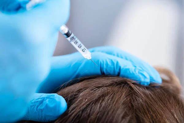 Médico Dando Injeção Para Seu Paciente Para Queda Cabelo — Fotografia de Stock