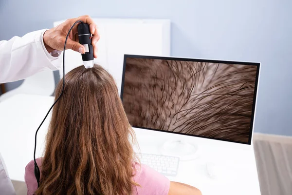 Zbliżenie Dermatologa Pomocą Trychoskopu Leczenia Wypadania Włosów Jego Klinika — Zdjęcie stockowe