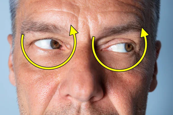 Άνθρωπος Κάνει Μετατόπιση Μάτι Άσκηση Για Βελτίωση Της Όρασης — Φωτογραφία Αρχείου