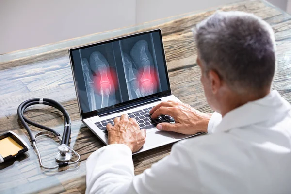 Doctor Mirando Los Pies Rayos Ordenador Portátil Con Estetoscopio — Foto de Stock