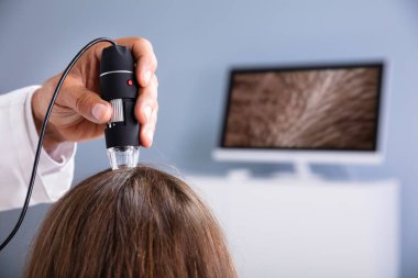 Saç Düşme Tedavisi Için Trichoscope Kullanarak Dermatolog Close-up Kliniği