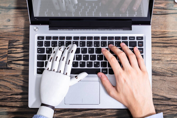 Man With Prosthetic Hand Working On Laptop. Artificial Limb