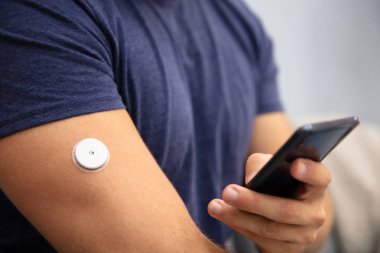 Cep telefonunda sürekli glikoz monitörüyle Glikoz seviyesini test eden adam
