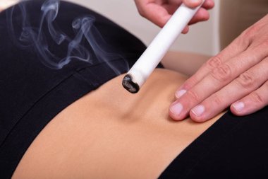 Close-up Of A Woman Lying On Bed Being Treated With Moxibustion Treatments In Clinic clipart
