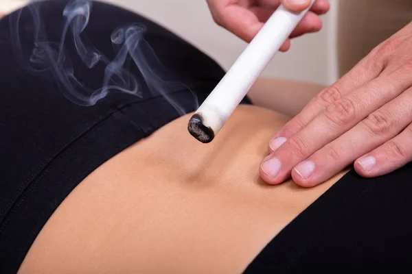 Közelkép Egy Nőről Aki Ágyon Fekszik Moxibustion Kezelésben Részesül Klinikán — Stock Fotó