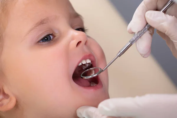 Zbliżenie Dentysty Pediatry Badającego Zęby Małej Dziewczynki Dentystów — Zdjęcie stockowe