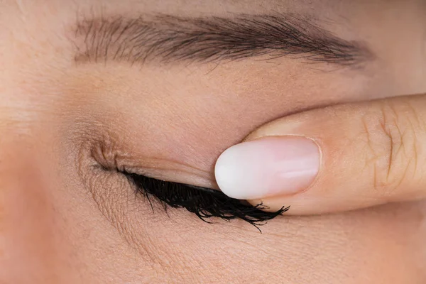 Close Woman Massageando Olho Infectado — Fotografia de Stock