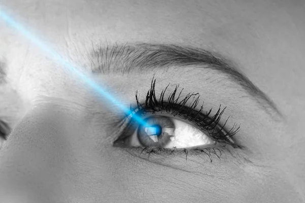 Conceptul Corecție Vederii Laser Fotografie Femeii Tinere — Fotografie, imagine de stoc