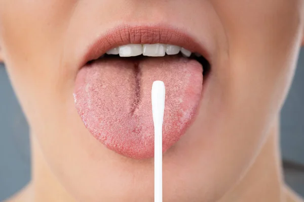 Dentista Fazendo Teste Saliva Paciente — Fotografia de Stock