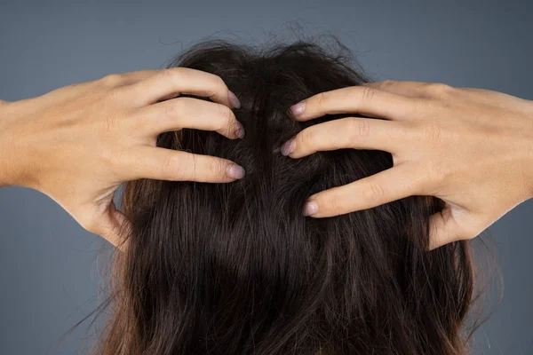 Jeune Femme Gratter Son Cuir Chevelu Tête Démangeaison — Photo