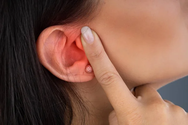 Foto Einer Jungen Frau Die Ohrenschmerzen Leidet — Stockfoto