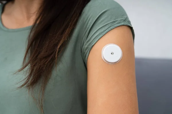 Close-up Of A Woman Testing Glucose Level With A Continuous Glucose Monitor On Her Arm