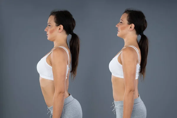 Woman With Lordosis And Normal Curvature Against Gray Background — Stock Image Woman Lordosis Normal Curvature Gray Background Royalty Free Stock Images