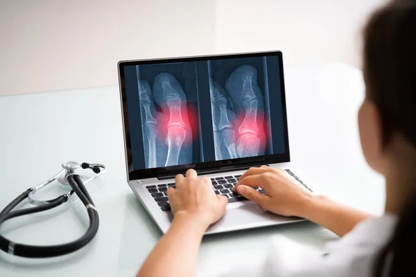 应用计算机技术对骨科X射线扫描的外科医生 — 图库照片