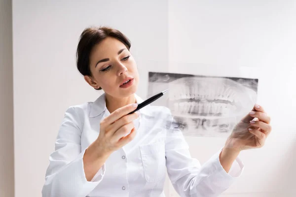 Dentystyczne Zęby Mądrości Dental Ray Imaging — Zdjęcie stockowe