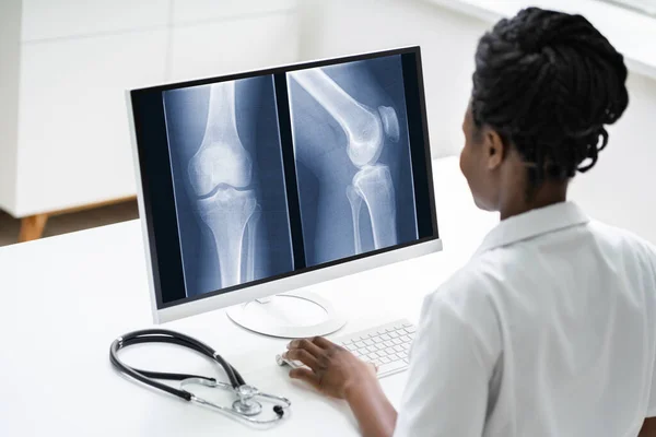 Chirurgen Arzt Bei Röntgenuntersuchung Des Knie Knochens Mit Software Technologie — Stockfoto