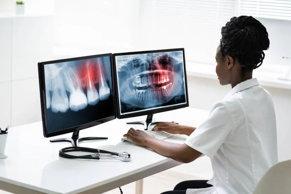 牙科医生使用电脑软件检查牙齿X光 — 图库照片