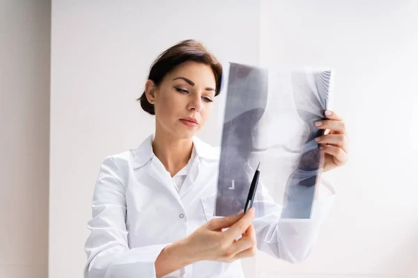 Cirujano Doctor Sosteniendo Rodilla Hueso Radiografía Escáner —  Fotos de Stock