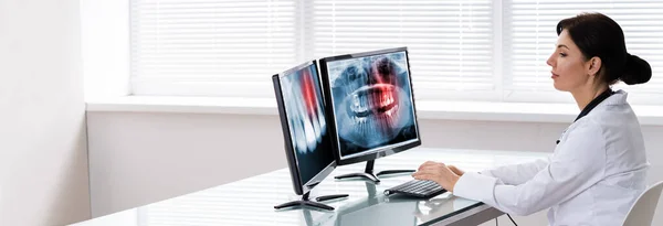 Médico Dentista Olhando Para Dentes Xray Computador — Fotografia de Stock