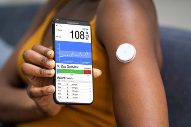 Sürekli glikoz monitörü Kan şekeri testi akıllı telefon uygulaması