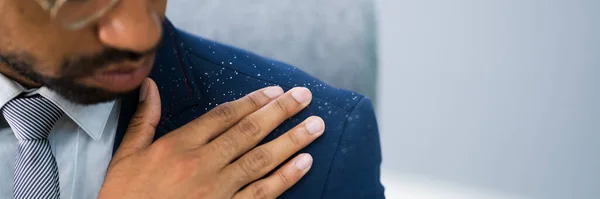 Pria Afrika Menyikat Dandruff Dari Setelan Kotor — Stok Foto