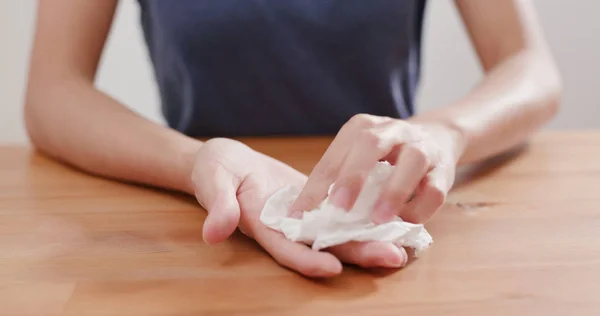 Frau Leidet Unter Handschweiß — Stockfoto