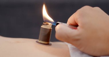 Chinese medicine moxibustion therapy  clipart