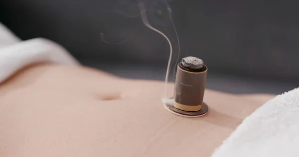 Chinese Geneeskunde Moxibustion Therapie — Stockfoto