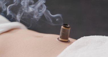 Chinese traditional medicine moxibustion therapy  clipart