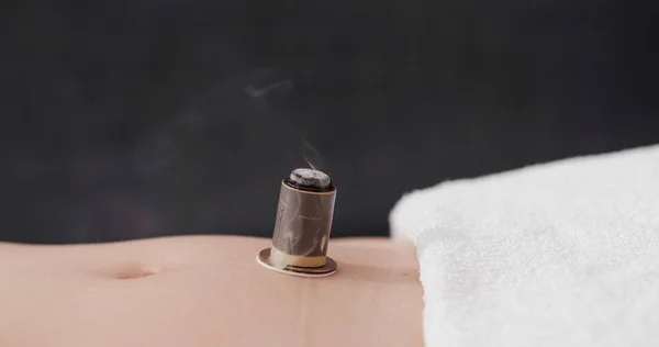 Medicina Tradicional Chinesa Moxibustion Terapia — Fotografia de Stock