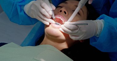 Asya kadın var diş kontrol yukarı